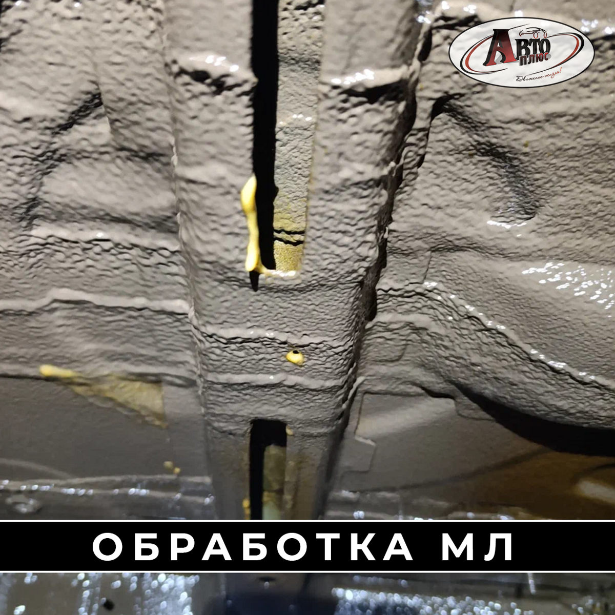 ml_992638
